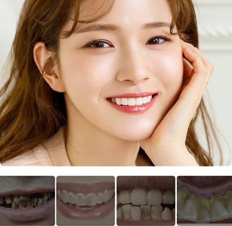 Lápiz blanqueador dental