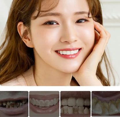 Lápiz blanqueador dental